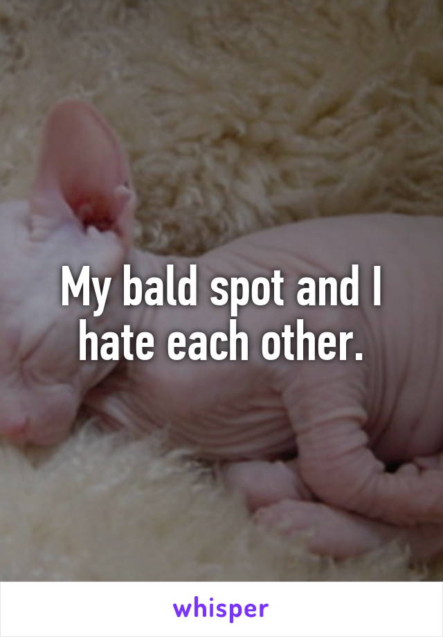 My bald spot and I hate each other.