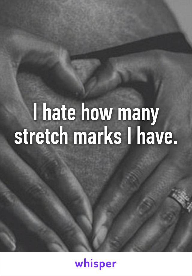 I hate how many stretch marks I have. 