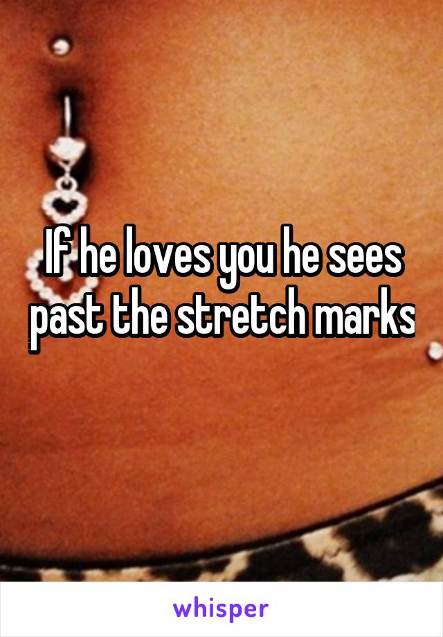 If he loves you he sees past the stretch marks 