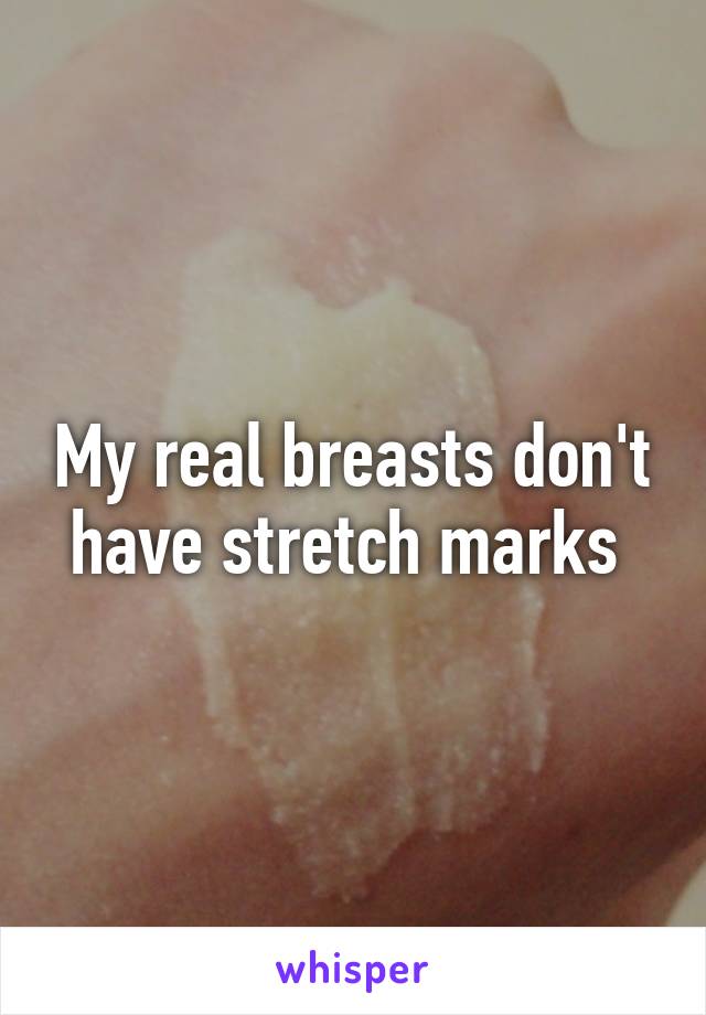 My real breasts don't have stretch marks 