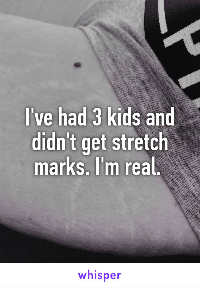 I've had 3 kids and didn't get stretch marks. I'm real. 
