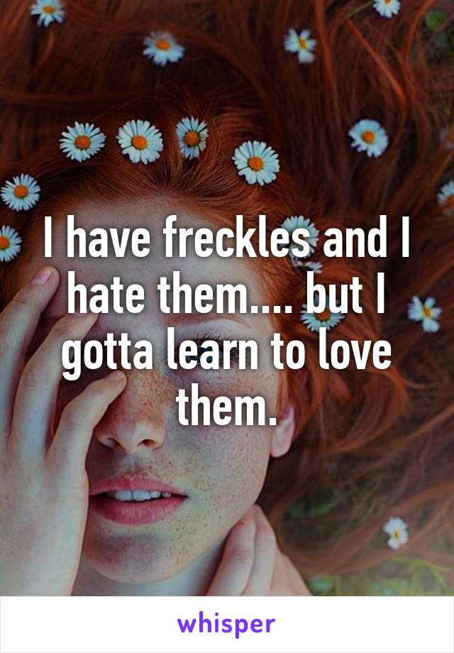 I have freckles and I hate them.... but I gotta learn to love them.
