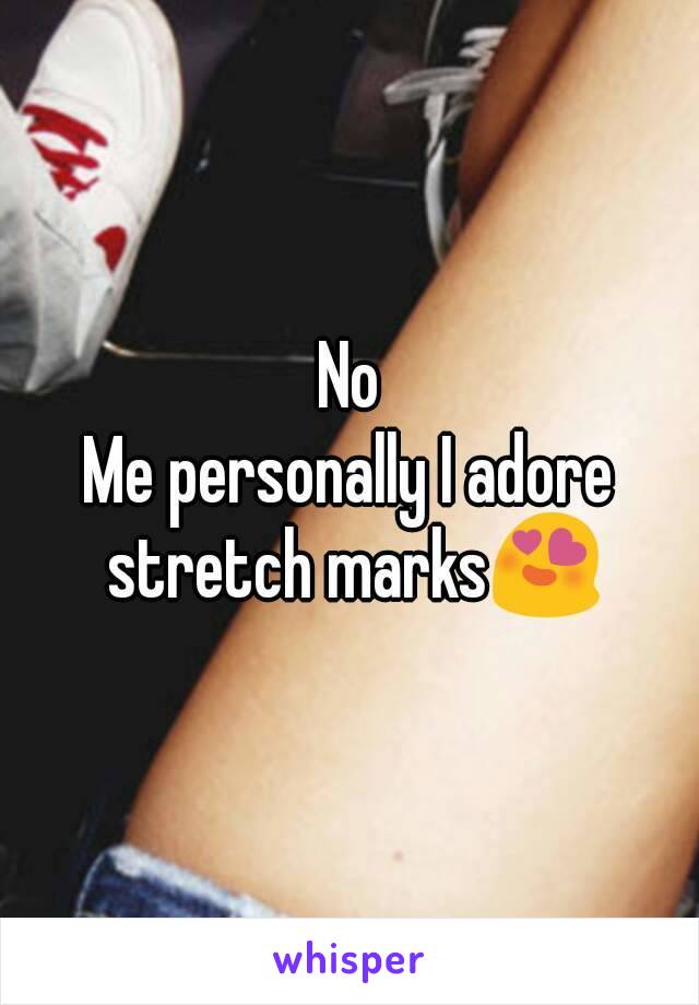 No
Me personally I adore stretch marks😍