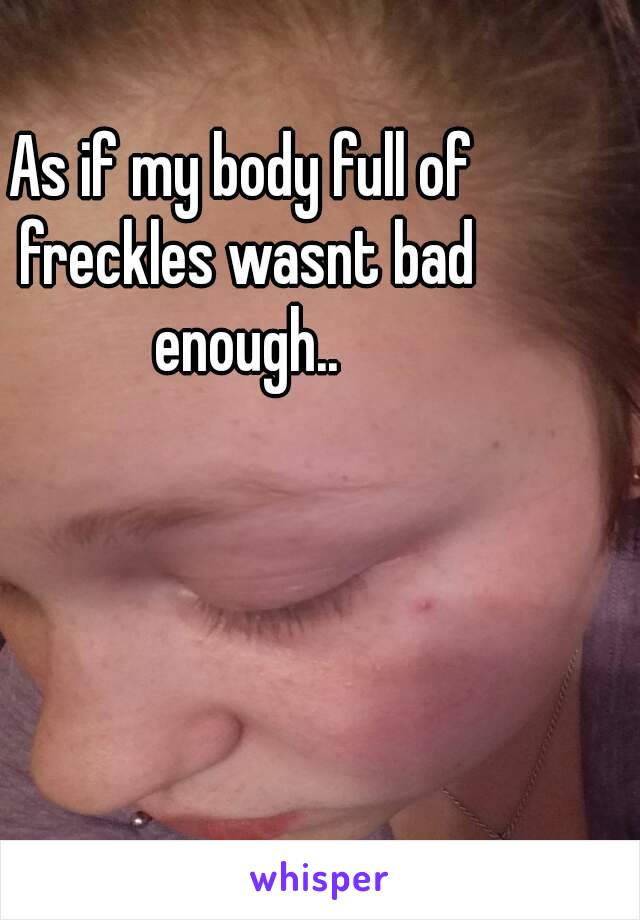 As if my body full of freckles wasnt bad enough..