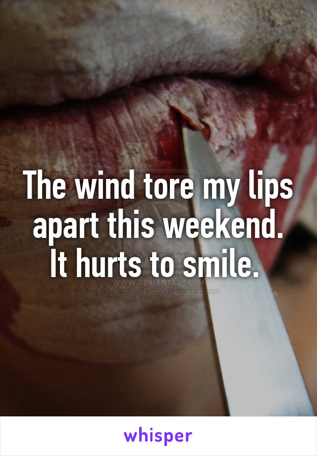 The wind tore my lips apart this weekend.
It hurts to smile. 