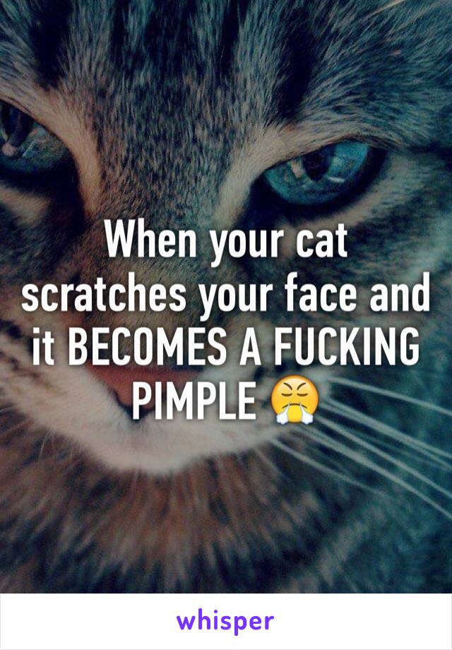 When your cat scratches your face and it BECOMES A FUCKING PIMPLE 😤