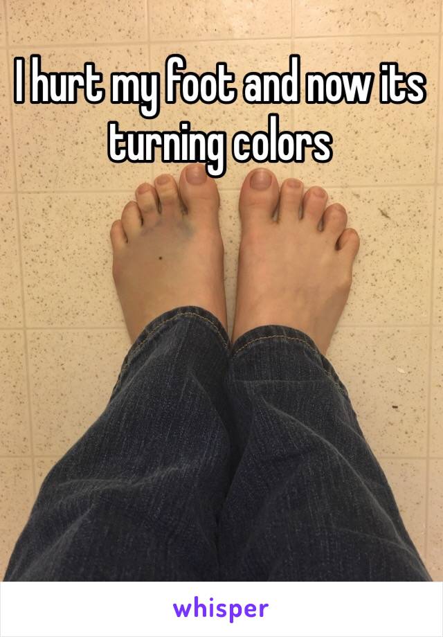 I hurt my foot and now its turning colors