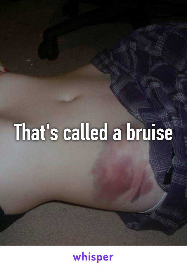 That's called a bruise