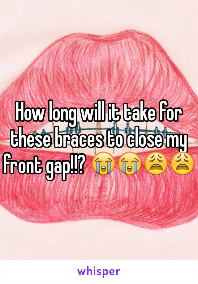 How long will it take for these braces to close my front gap!!? 😭😭😩😩