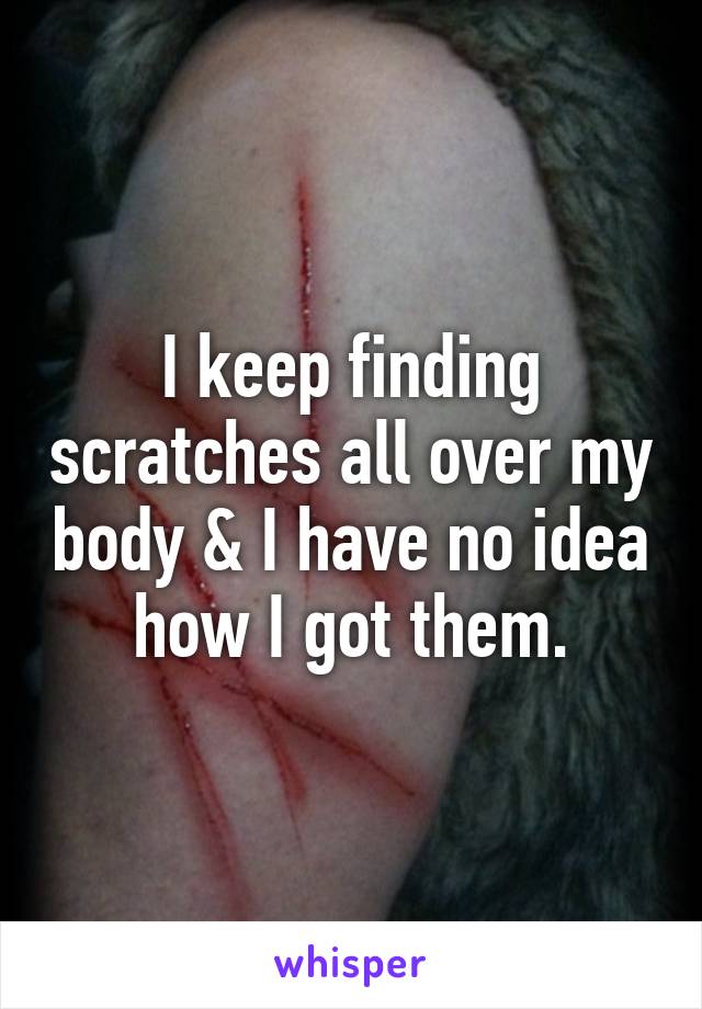 I keep finding scratches all over my body & I have no idea how I got them.