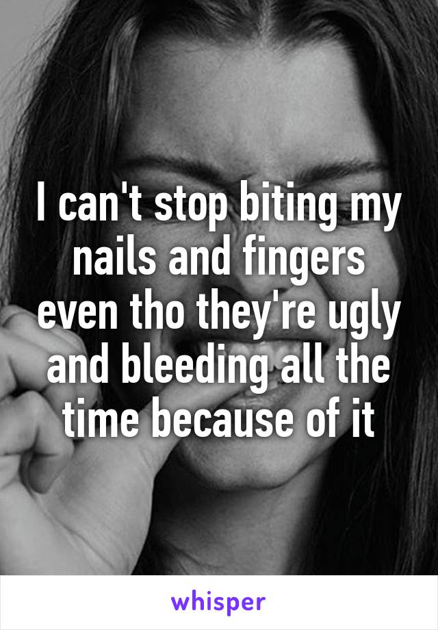 I can't stop biting my nails and fingers even tho they're ugly and bleeding all the time because of it