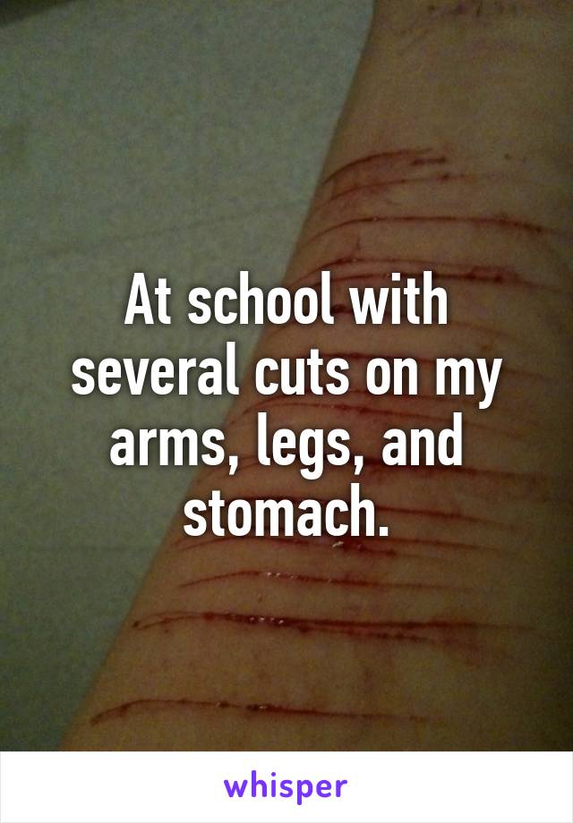 At school with several cuts on my arms, legs, and stomach.