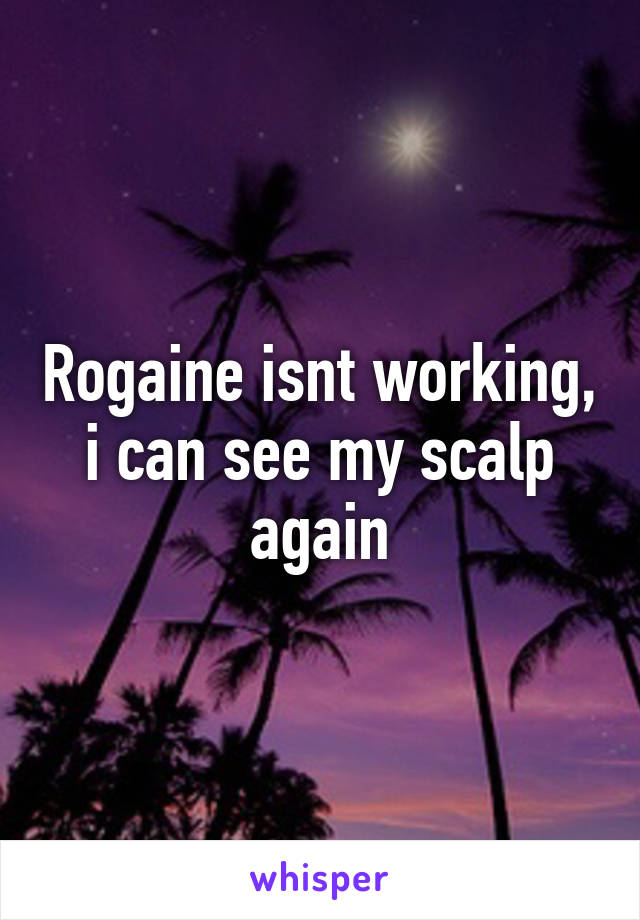 Rogaine isnt working, i can see my scalp again