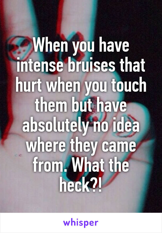 When you have intense bruises that hurt when you touch them but have absolutely no idea where they came from. What the heck?!