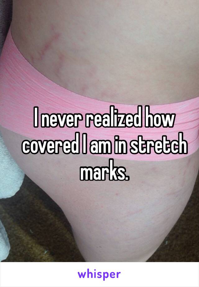 I never realized how covered I am in stretch marks. 