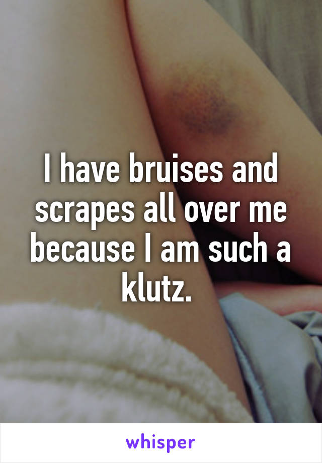 I have bruises and scrapes all over me because I am such a klutz. 