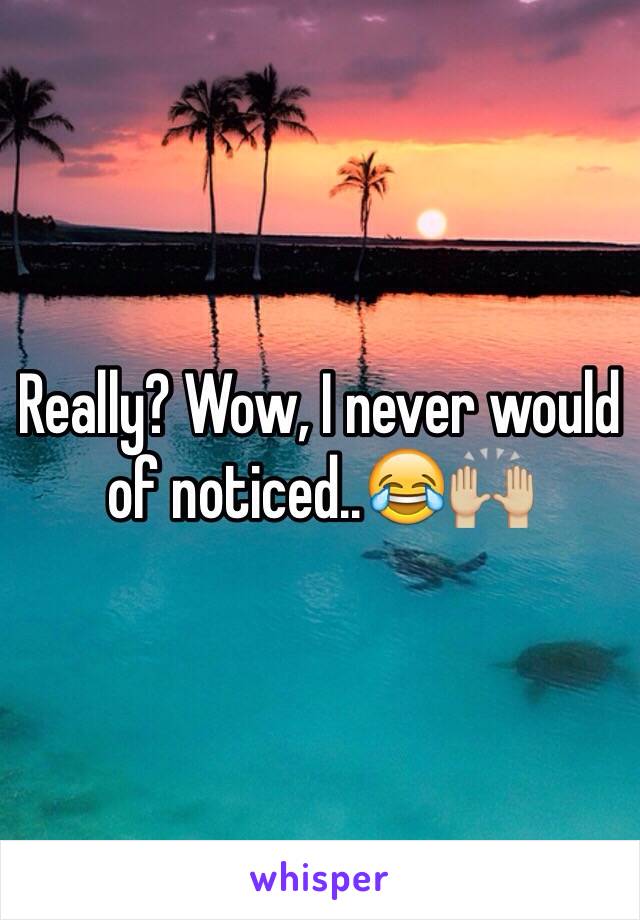 Really? Wow, I never would of noticed..😂🙌🏼