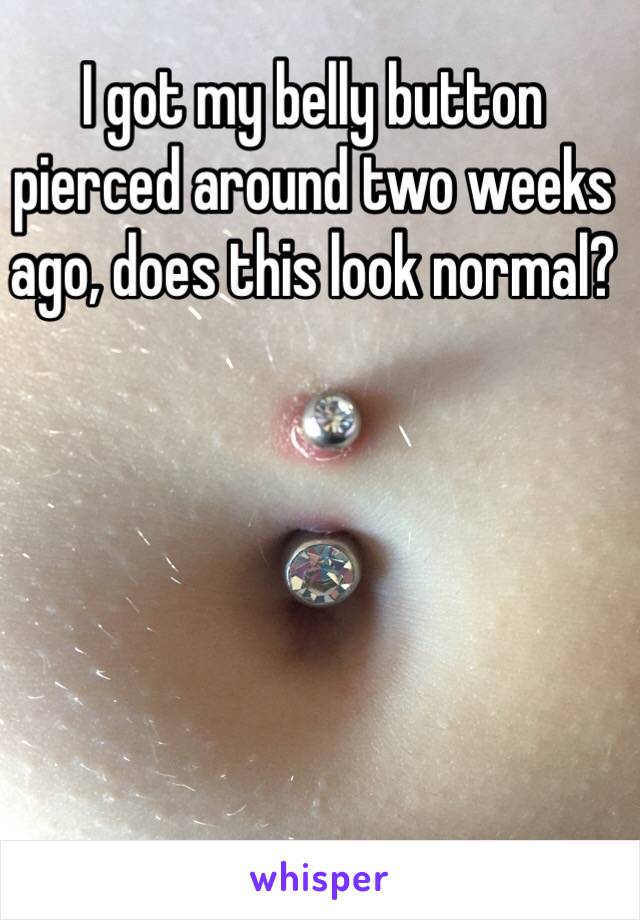 I got my belly button pierced around two weeks ago, does this look normal?