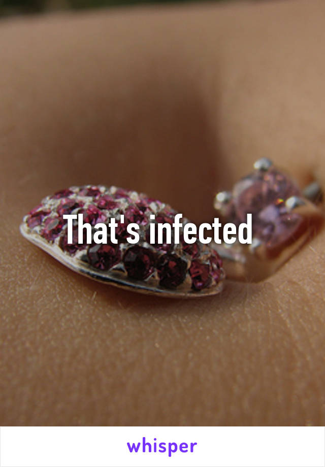 That's infected 