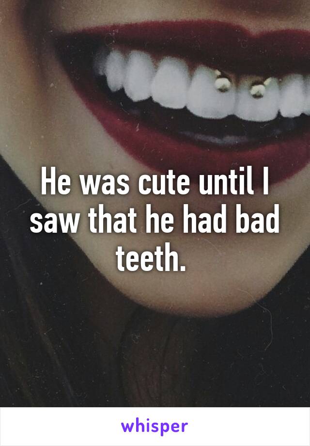 He was cute until I saw that he had bad teeth. 