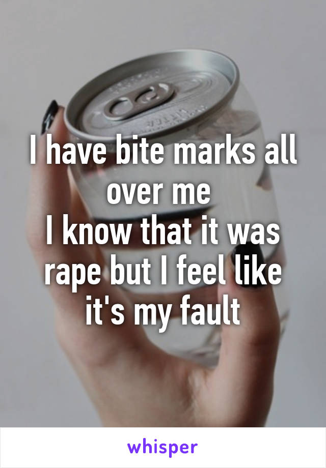 I have bite marks all over me 
I know that it was rape but I feel like it's my fault