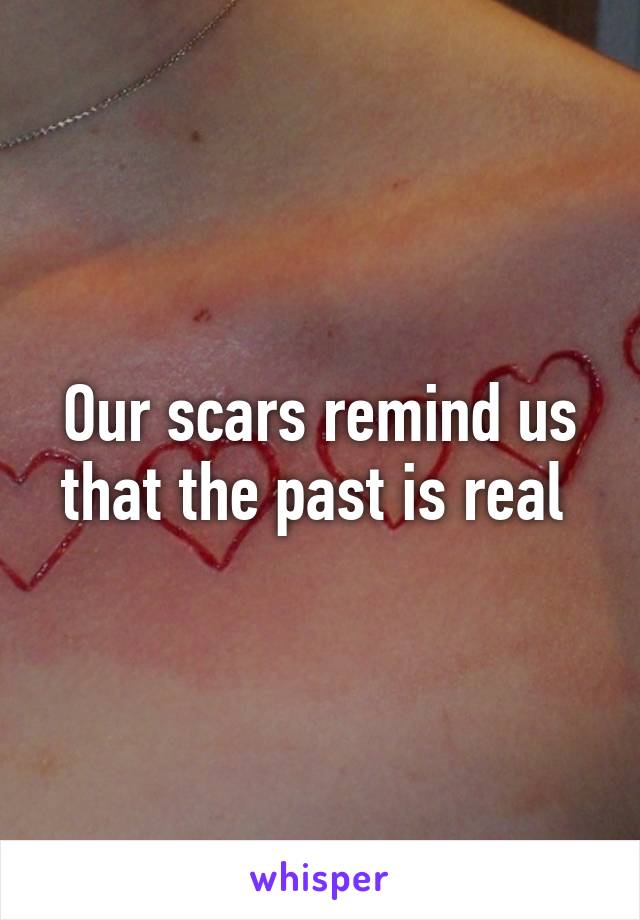 Our scars remind us that the past is real 