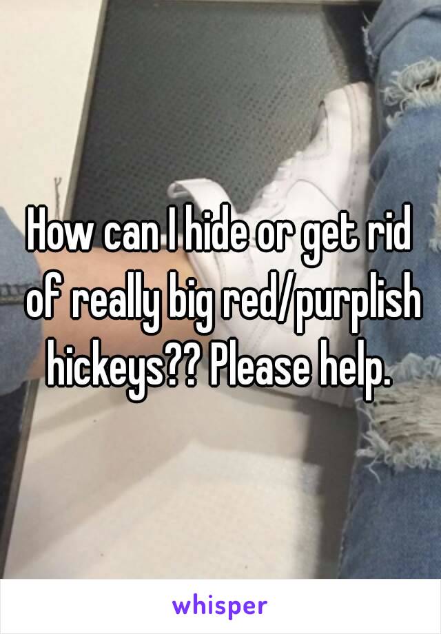 How can I hide or get rid of really big red/purplish hickeys?? Please help. 