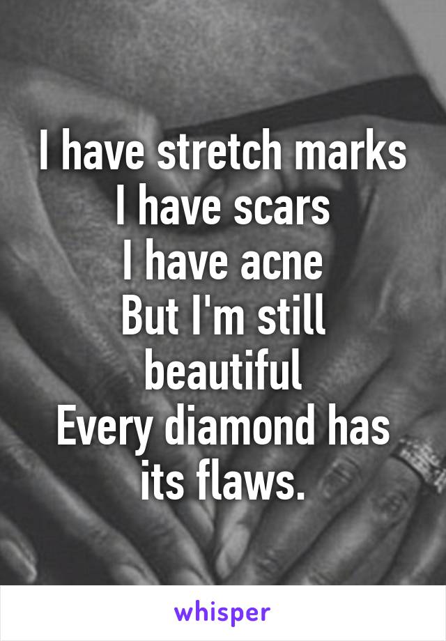 I have stretch marks
I have scars
I have acne
But I'm still beautiful
Every diamond has its flaws.