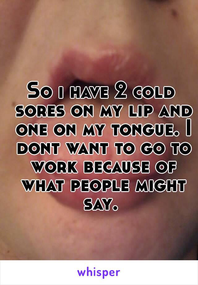 So i have 2 cold sores on my lip and one on my tongue. I dont want to go to work because of what people might say. 
