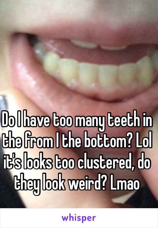 Do I have too many teeth in the from I the bottom? Lol it's looks too clustered, do they look weird? Lmao 