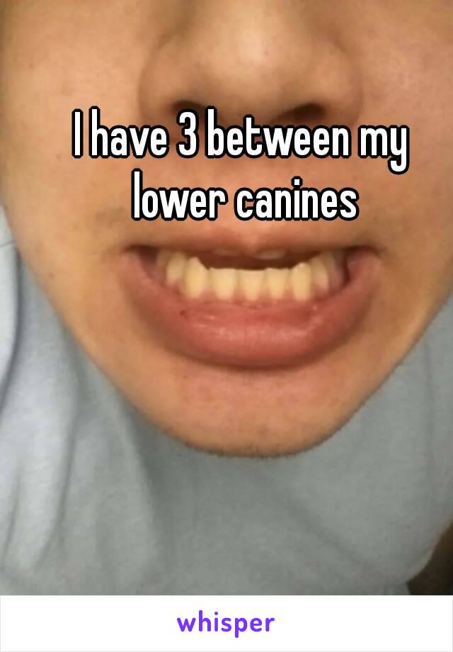 I have 3 between my lower canines