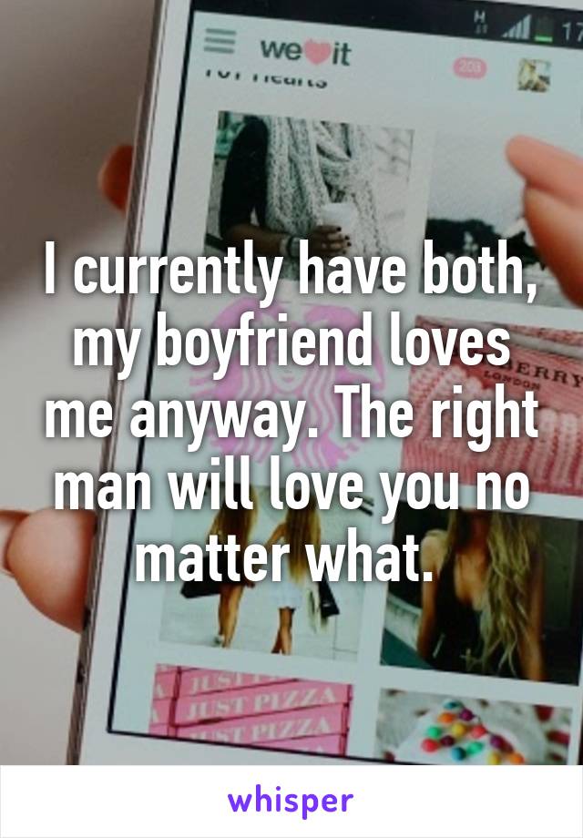 I currently have both, my boyfriend loves me anyway. The right man will love you no matter what. 