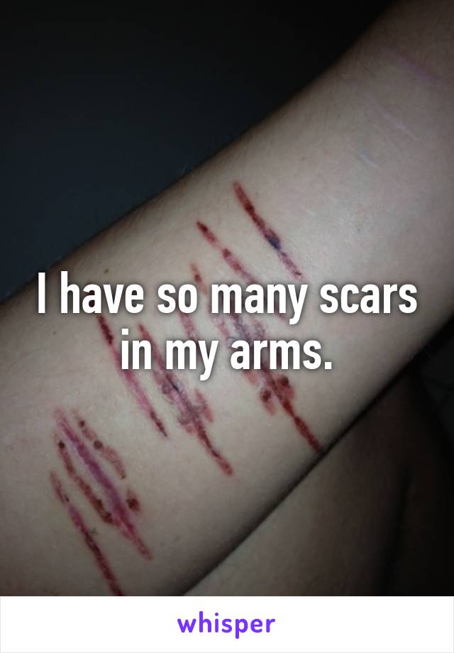 I have so many scars in my arms.