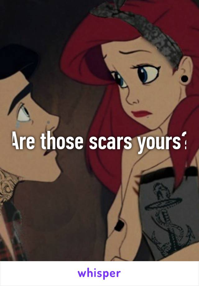 Are those scars yours?