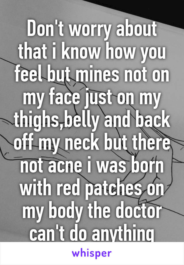 Don't worry about that i know how you feel but mines not on my face just on my thighs,belly and back off my neck but there not acne i was born with red patches on my body the doctor can't do anything