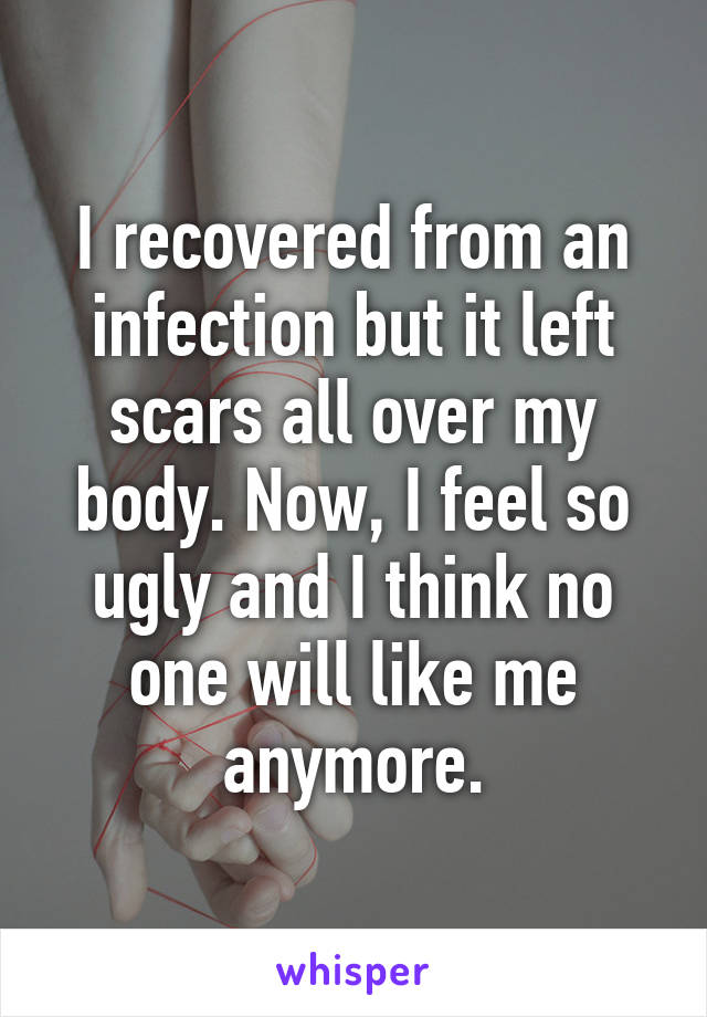 I recovered from an infection but it left scars all over my body. Now, I feel so ugly and I think no one will like me anymore.
