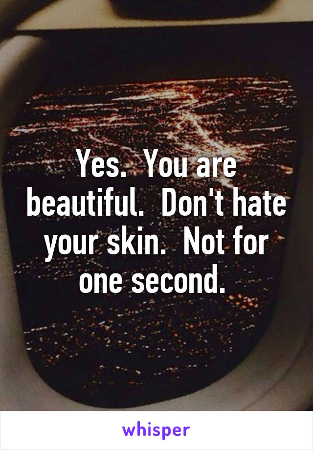 Yes.  You are beautiful.  Don't hate your skin.  Not for one second. 