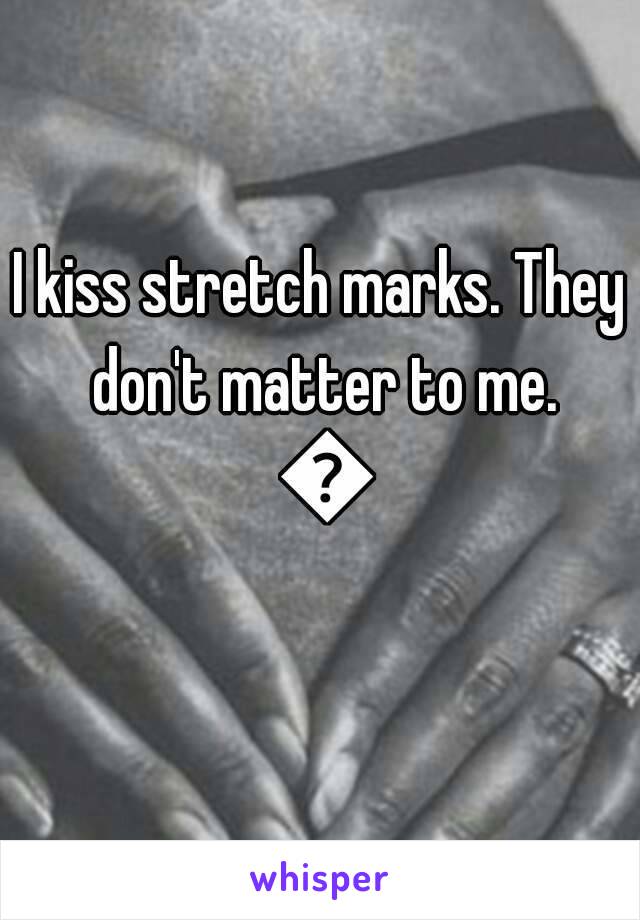 I kiss stretch marks. They don't matter to me. 😊