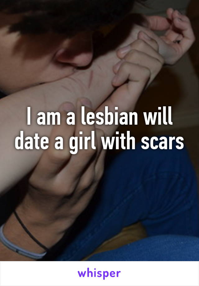 I am a lesbian will date a girl with scars 