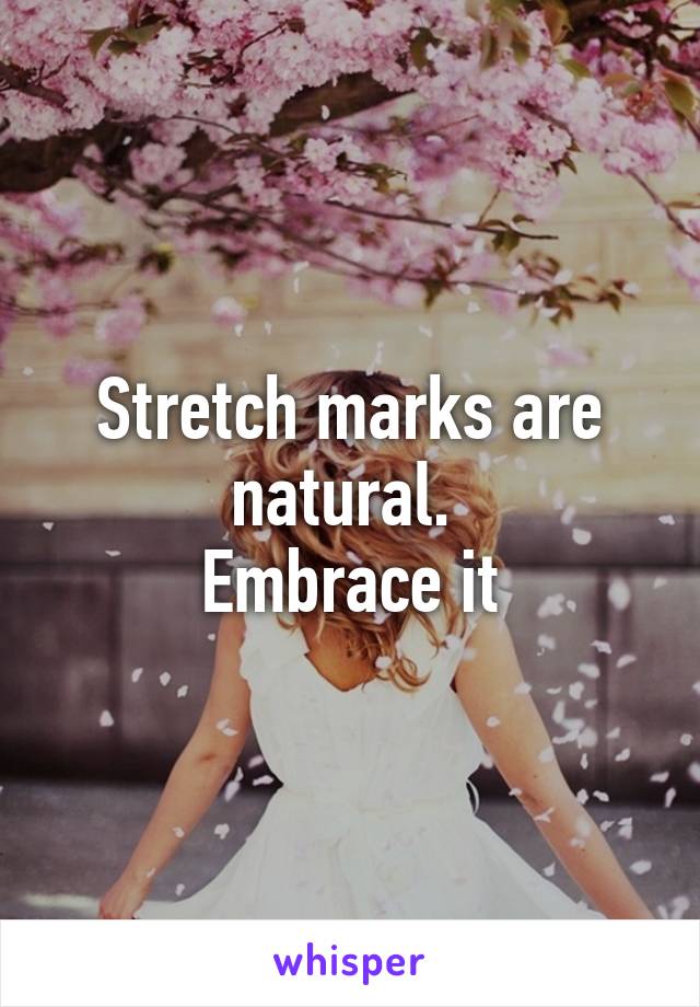 Stretch marks are natural. 
Embrace it