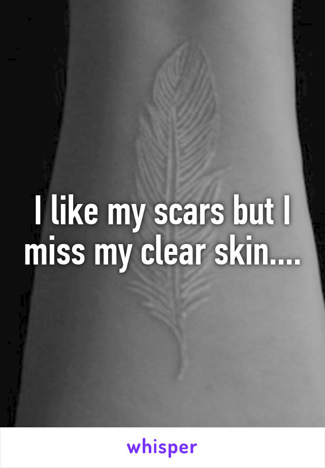 I like my scars but I miss my clear skin....