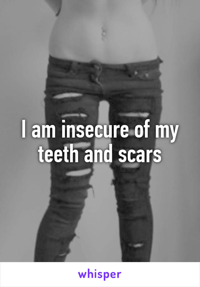 I am insecure of my teeth and scars