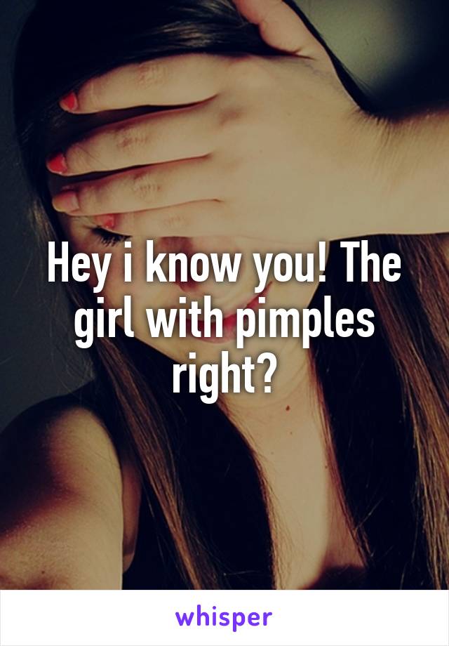 Hey i know you! The girl with pimples right?