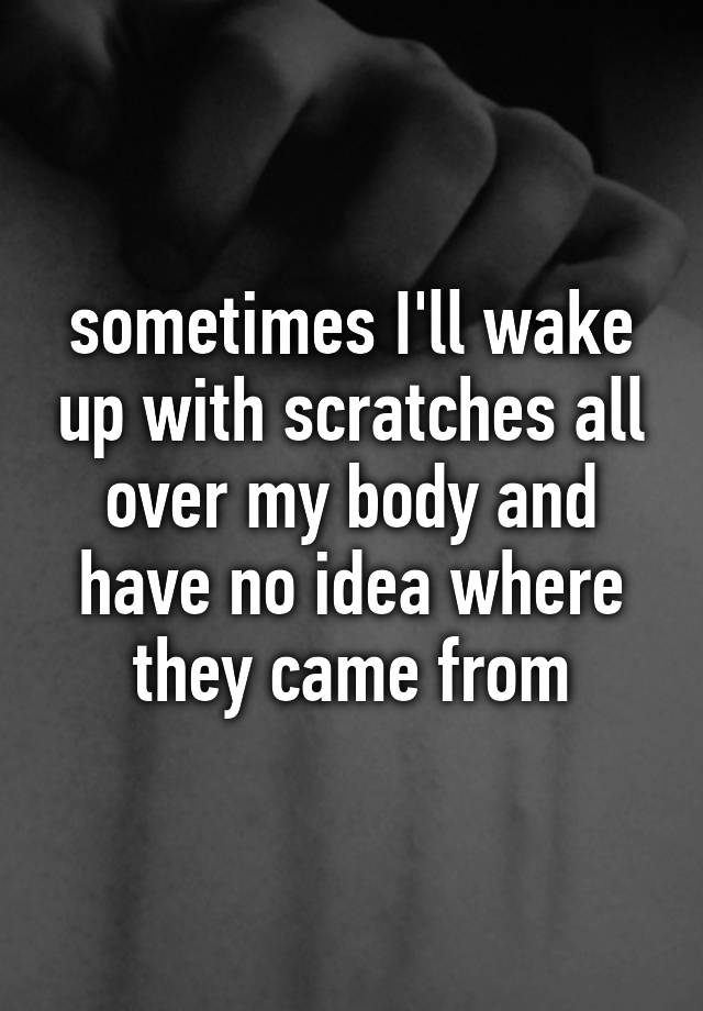 sometimes-i-ll-wake-up-with-scratches-all-over-my-body-and-have-no-idea