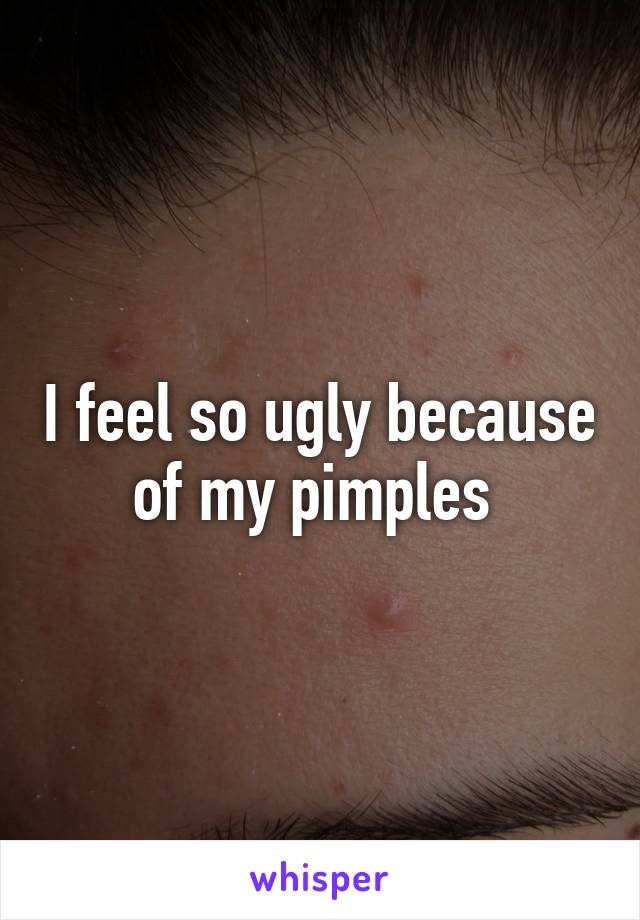 I feel so ugly because of my pimples 