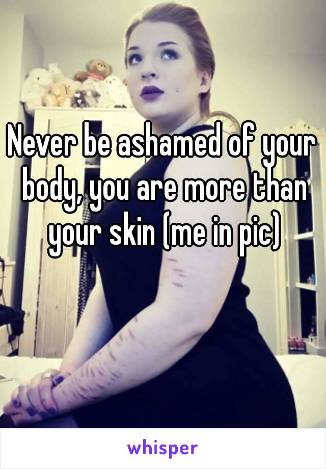 Never be ashamed of your body, you are more than your skin (me in pic)