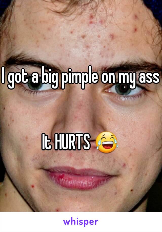 I got a big pimple on my ass


It HURTS 😂