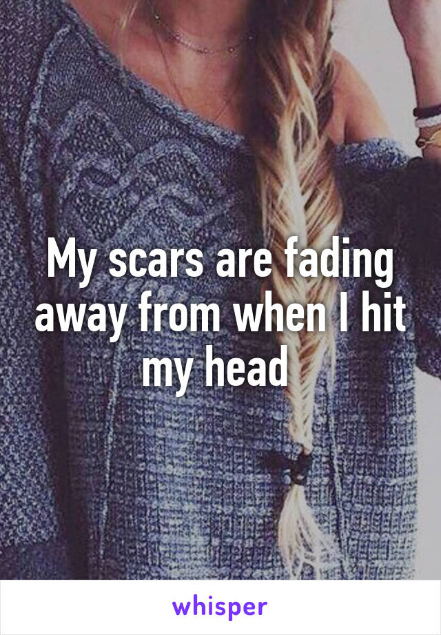 My scars are fading away from when I hit my head 