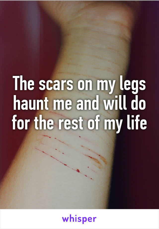 The scars on my legs haunt me and will do for the rest of my life 