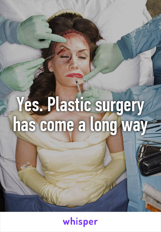 Yes. Plastic surgery has come a long way